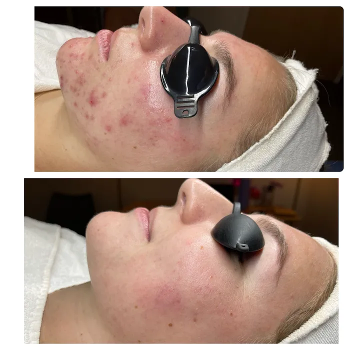 Acne Specialists of Long Beach Picture 3