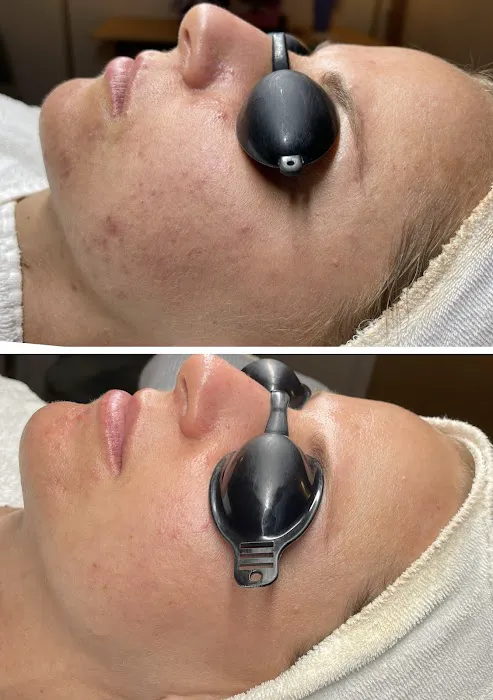 Acne Specialists of Long Beach Picture 6