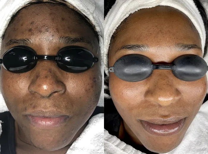 Acne Specialists of Long Beach Picture 9