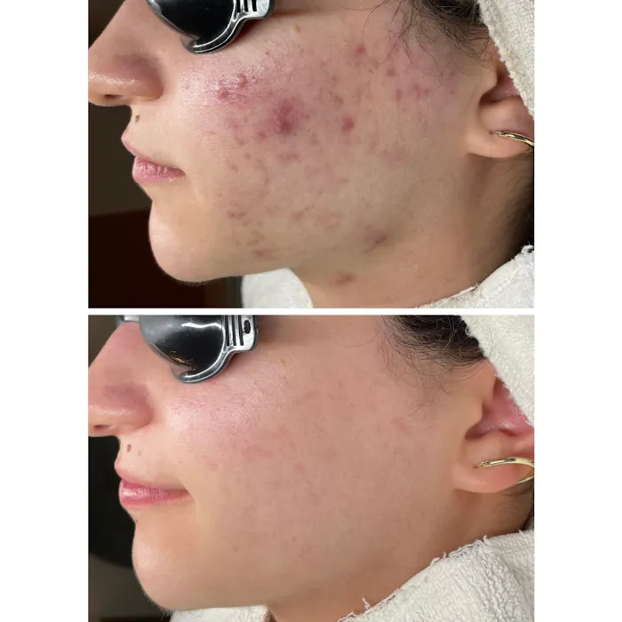 Acne Specialists of Long Beach Picture 10