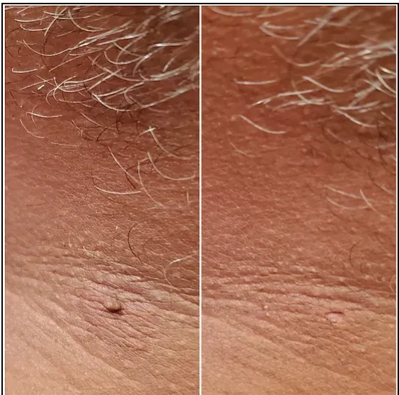 The Touch Picture 10