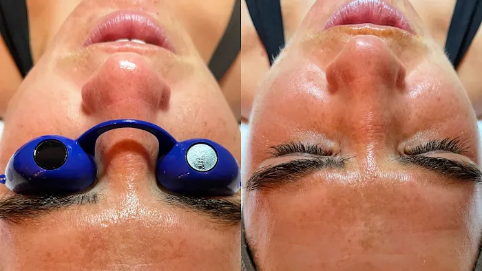 Skin Guru LA Picture 5