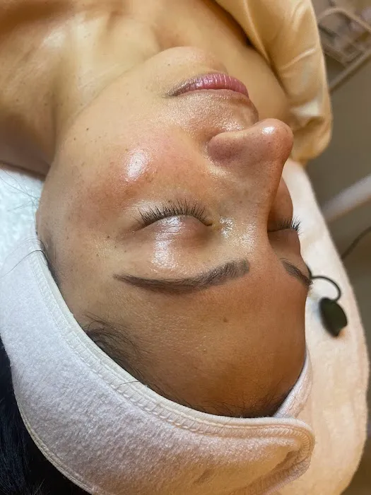 Skin Guru LA Picture 4