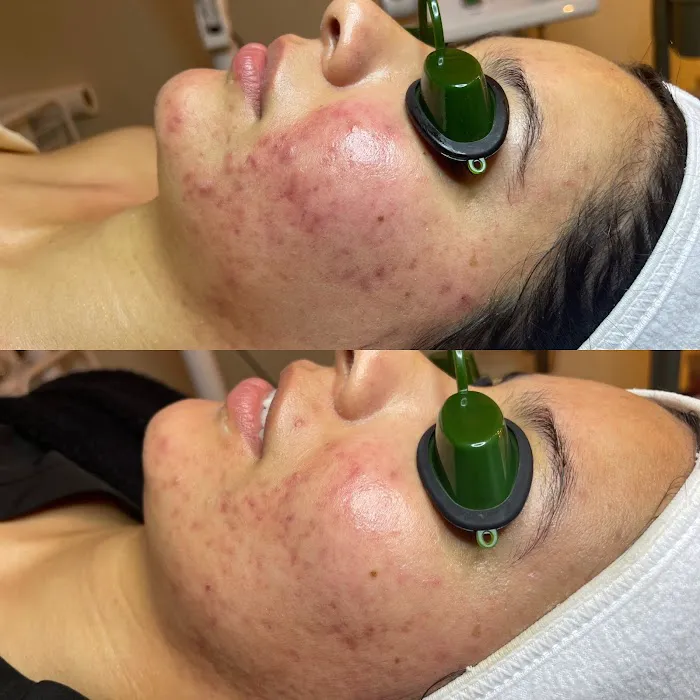 Skin Guru LA Picture 6