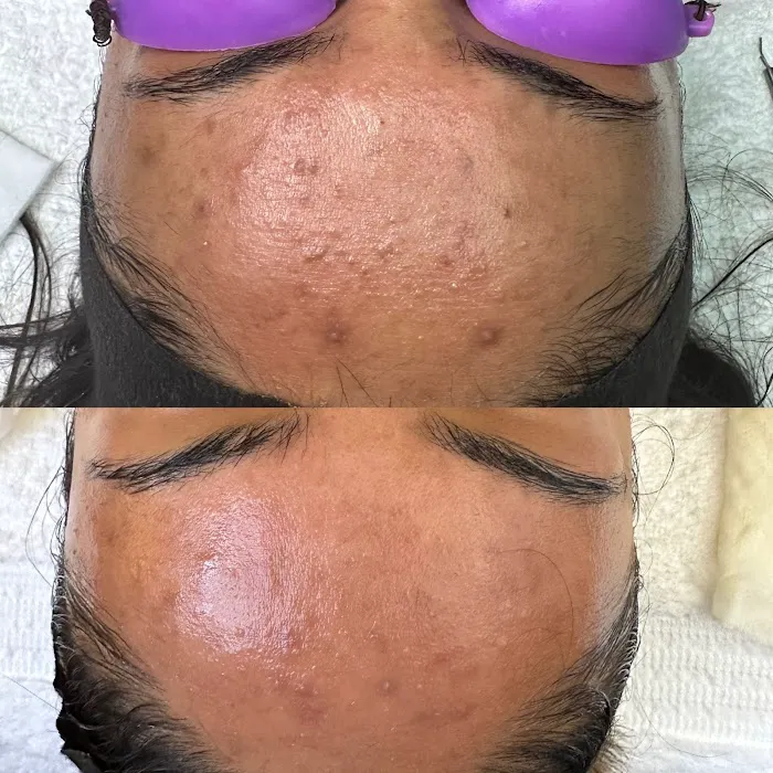 Skin Guru LA Picture 8