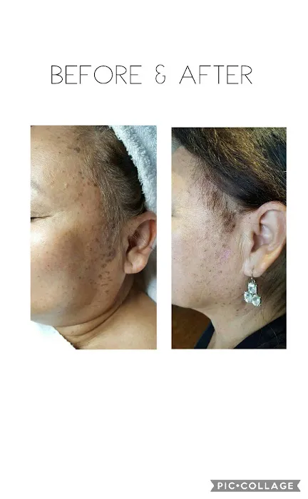 Lavon Skin Care Picture 7