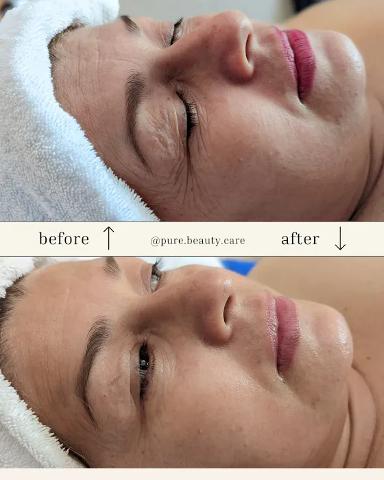 Pure Beauty Care Picture 3