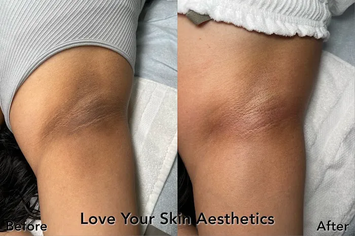 Love Your Skin Aesthetics Picture 2