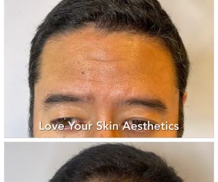 Love Your Skin Aesthetics
