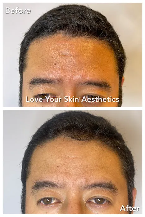 Love Your Skin Aesthetics Picture 5