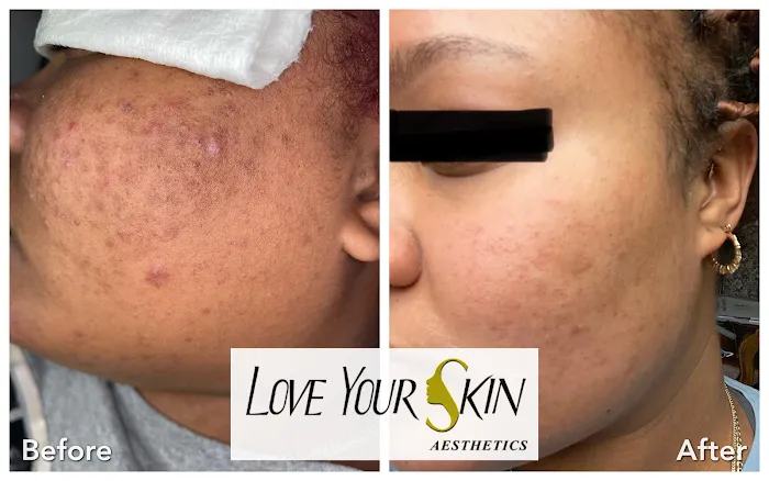 Love Your Skin Aesthetics Picture 6