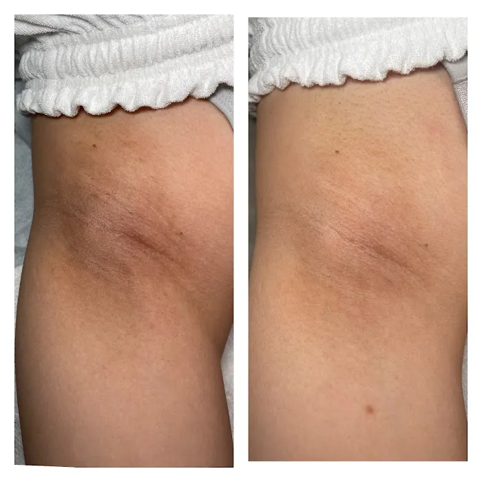 Love Your Skin Aesthetics Picture 7