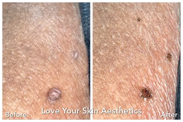 Love Your Skin Aesthetics Picture 9