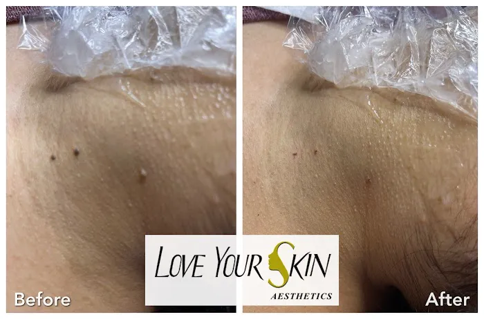 Love Your Skin Aesthetics Picture 10