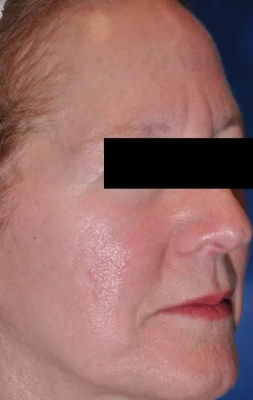 Maleva Skin Care Picture 10