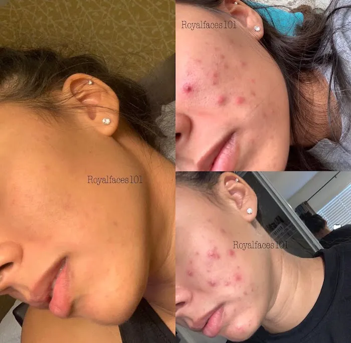 Royal Faces Skin Care Picture 6