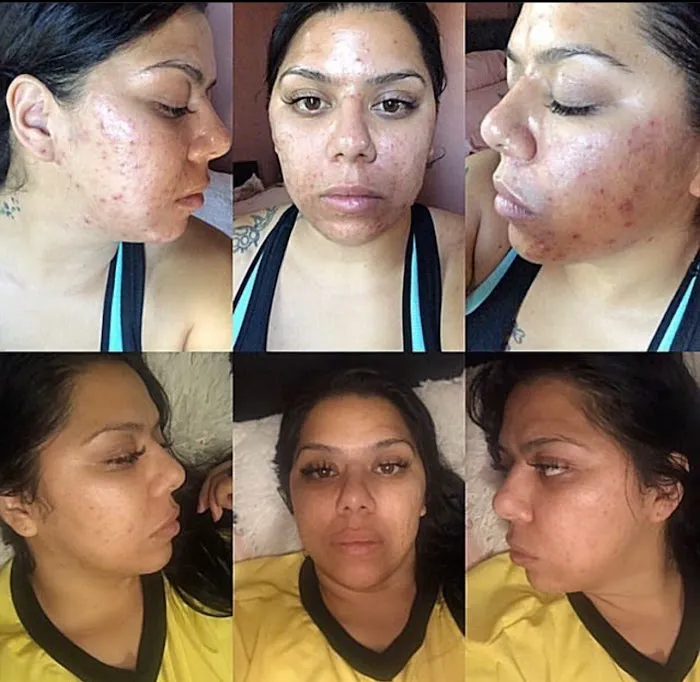 Royal Faces Skin Care Picture 9