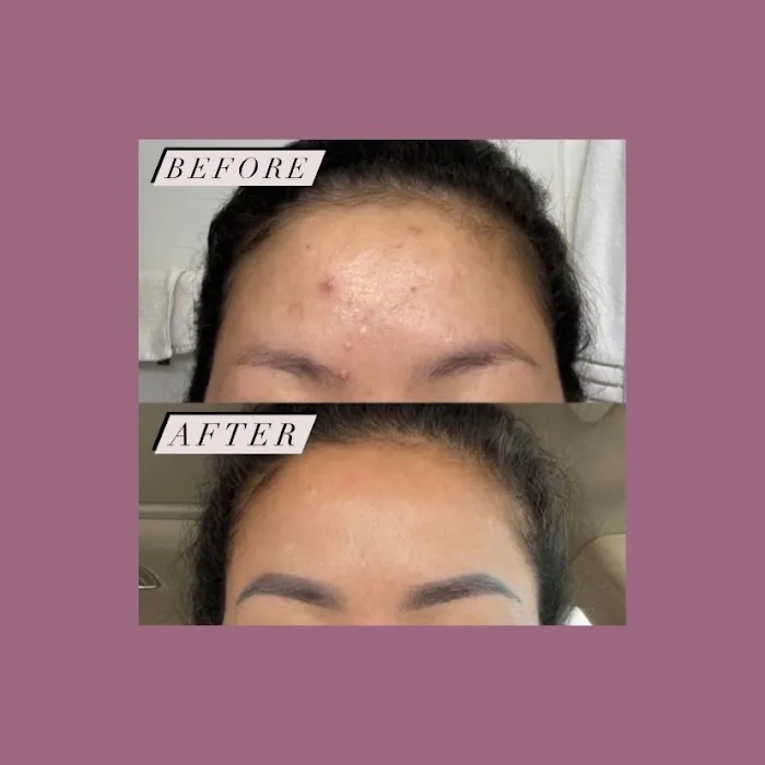 Awesthetics Picture 8