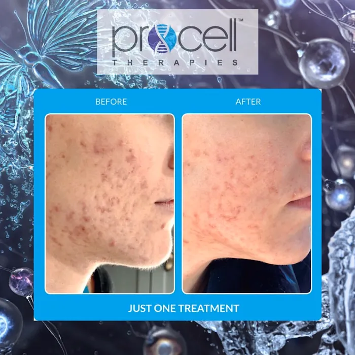 Downey Glo2Facial & Hydrafacial MD Skin Studio. Picture 3