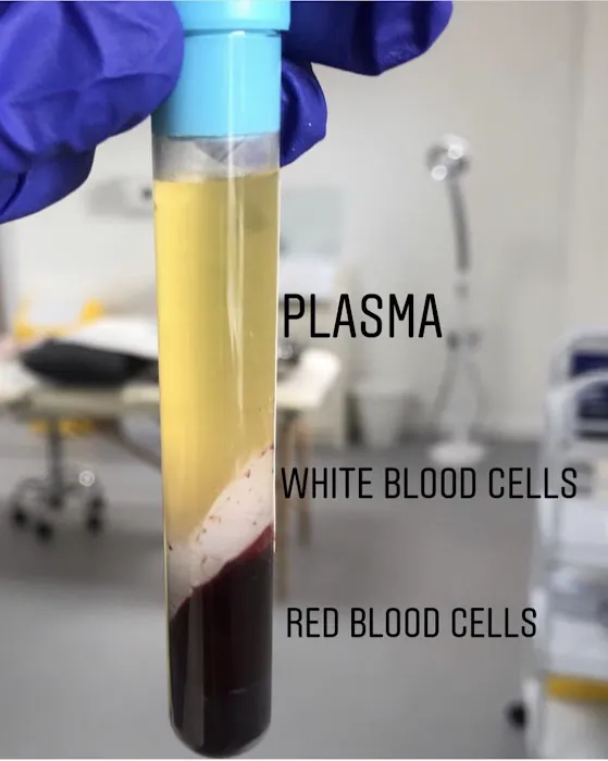 Downey Glo2Facial & Hydrafacial MD Skin Studio. Picture 4