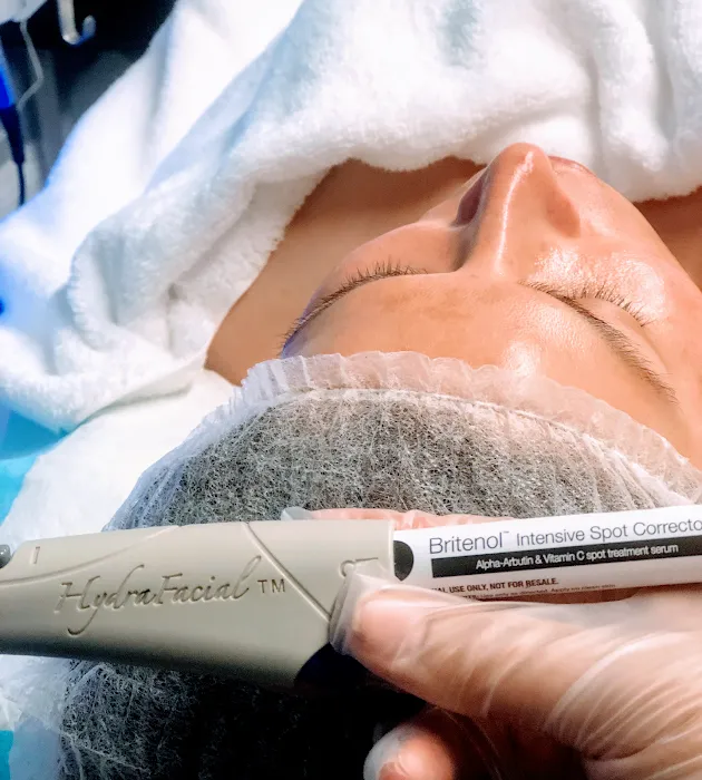 Downey Glo2Facial & Hydrafacial MD Skin Studio. Picture 5