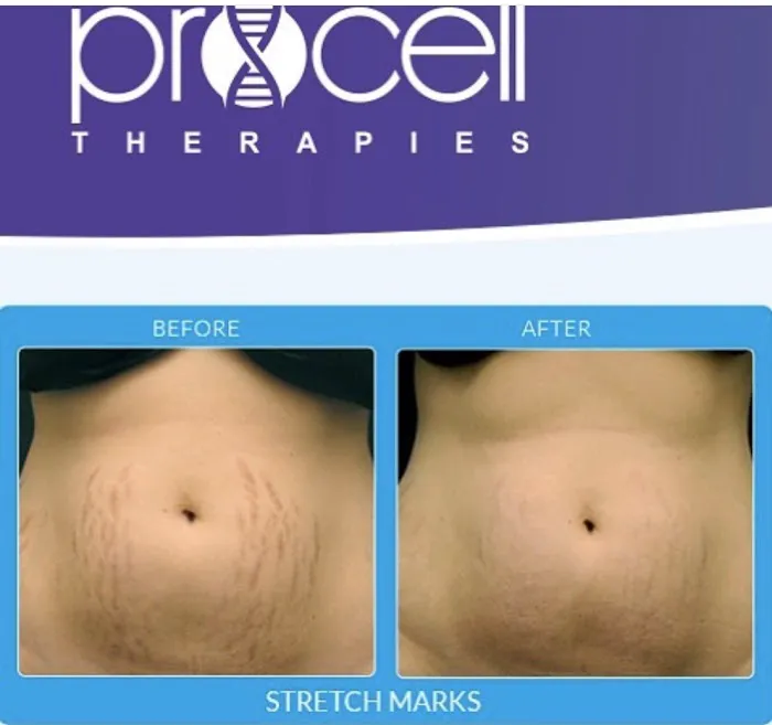 Downey Glo2Facial & Hydrafacial MD Skin Studio. Picture 9