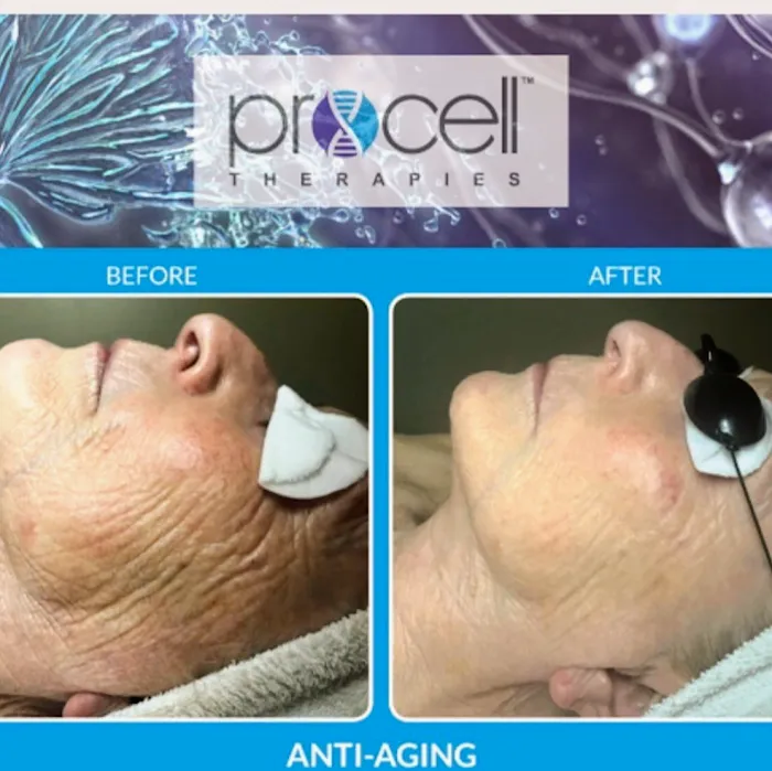 Downey Glo2Facial & Hydrafacial MD Skin Studio. Picture 10