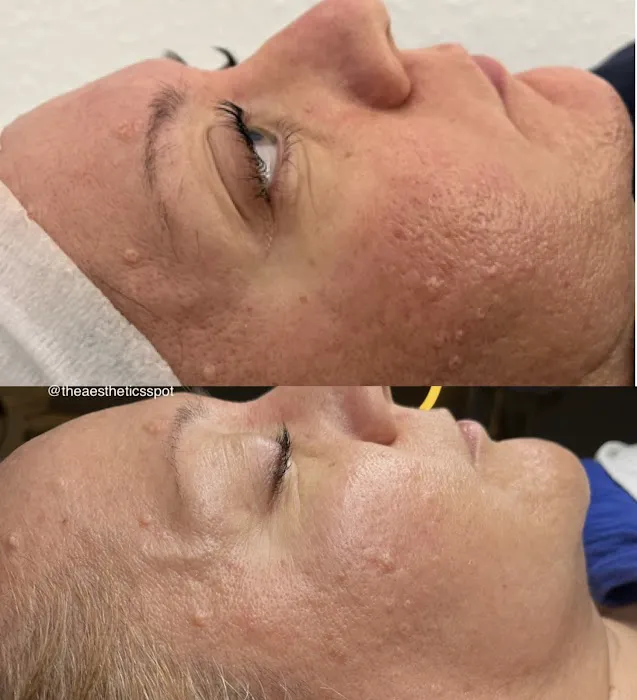 The Aesthetics Spot Picture 10