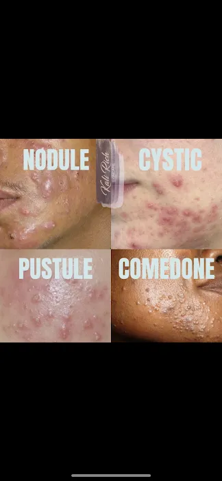 Kali Rich Skin & Beauty Picture 3