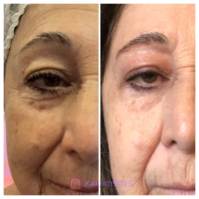 Kali Rich Skin & Beauty Picture 9