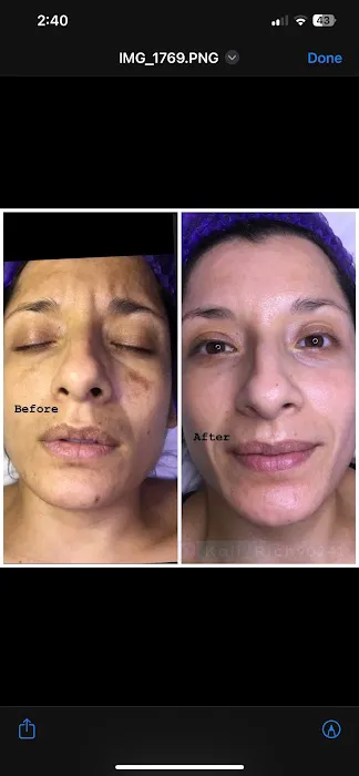 Kali Rich Skin & Beauty Picture 8