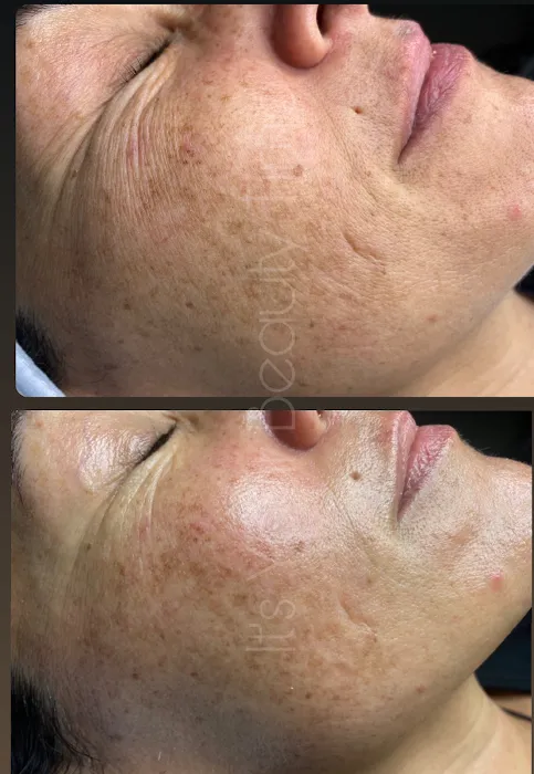 Its Your Beauty Time Picture 3