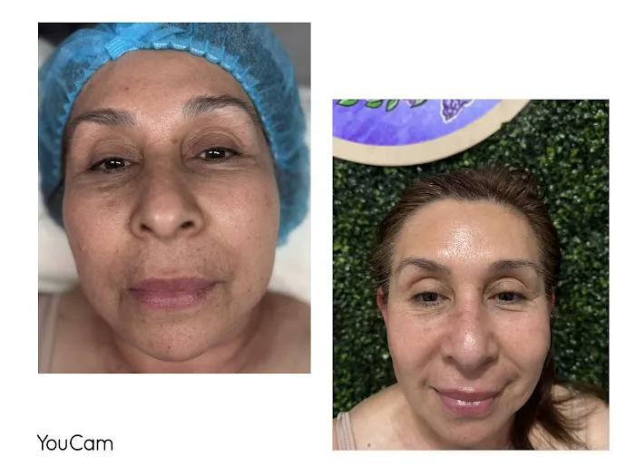 MJ skin luxe Picture 3