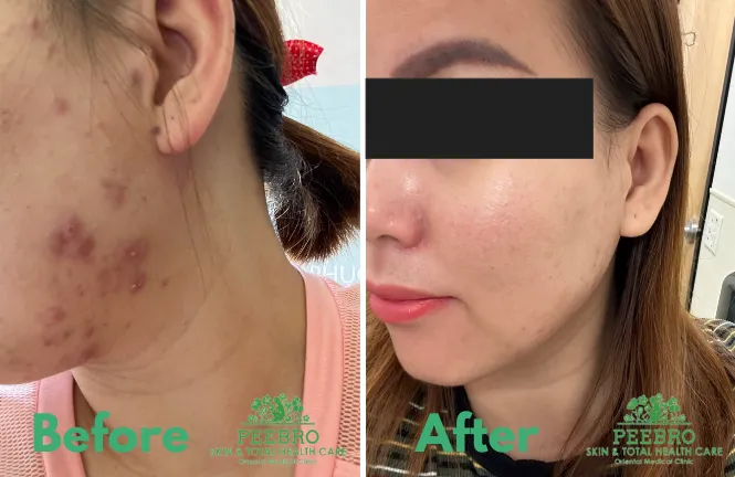 Peebro Skin & Total Health Care Picture 10