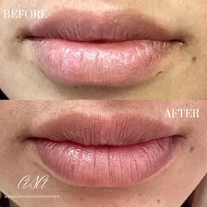 Amazing Skin Aesthetics Picture 5