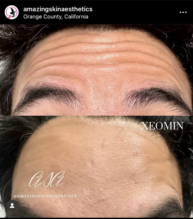 Amazing Skin Aesthetics Picture 6