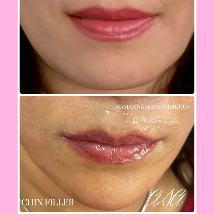 Amazing Skin Aesthetics Picture 8