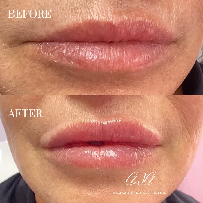 Amazing Skin Aesthetics Picture 9