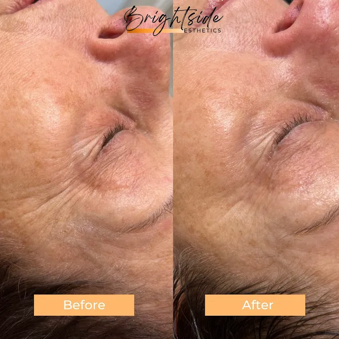 Brightside Esthetics- Facials & Waxing in Huntington Beach Picture 4