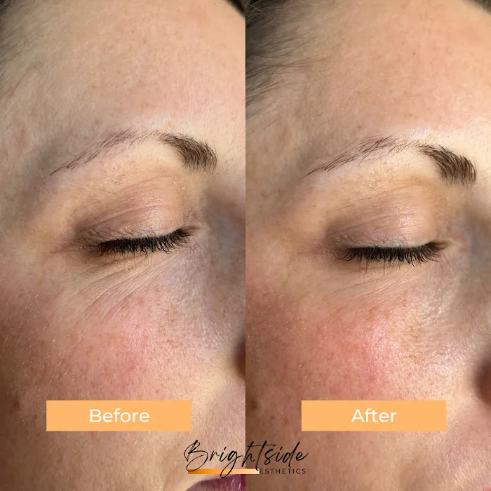 Brightside Esthetics- Facials & Waxing in Huntington Beach Picture 5