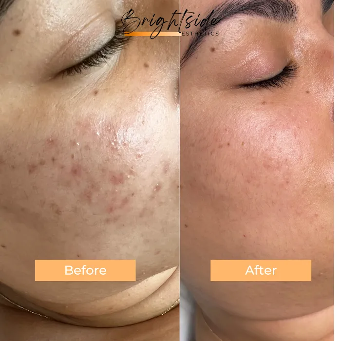 Brightside Esthetics- Facials & Waxing in Huntington Beach Picture 6