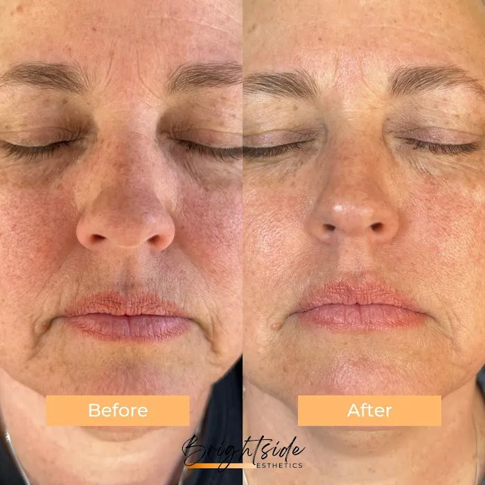 Brightside Esthetics- Facials & Waxing in Huntington Beach Picture 7