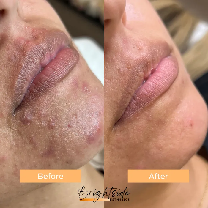 Brightside Esthetics- Facials & Waxing in Huntington Beach Picture 8