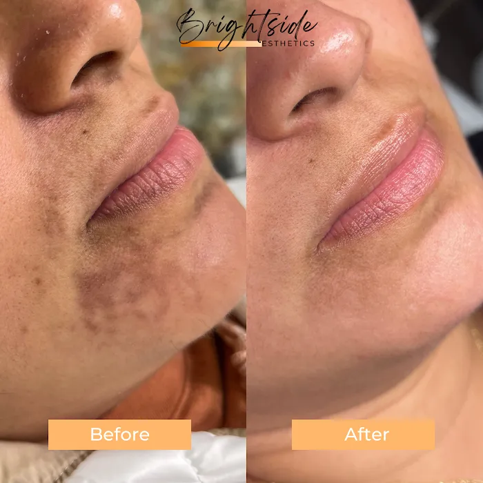 Brightside Esthetics- Facials & Waxing in Huntington Beach Picture 9