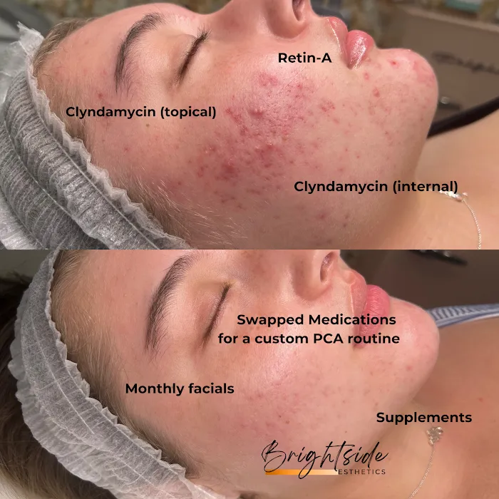 Brightside Esthetics- Facials & Waxing in Huntington Beach Picture 10