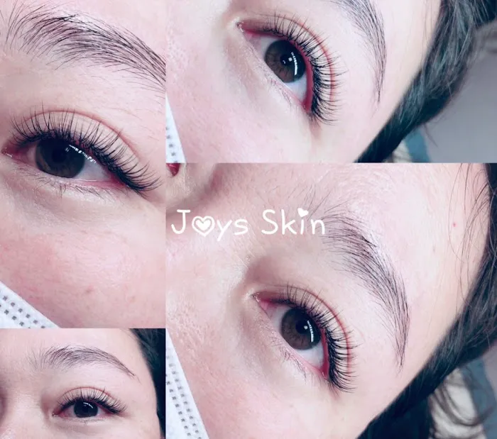 Joy Skincare Picture 1