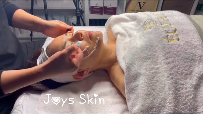 Joy Skincare Picture 5
