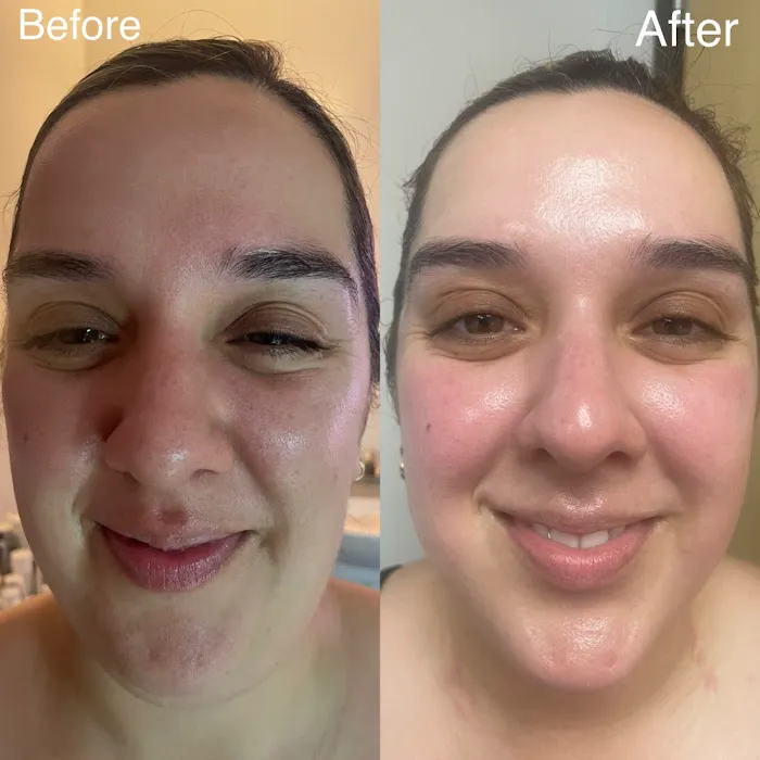 Joy Skincare Picture 7