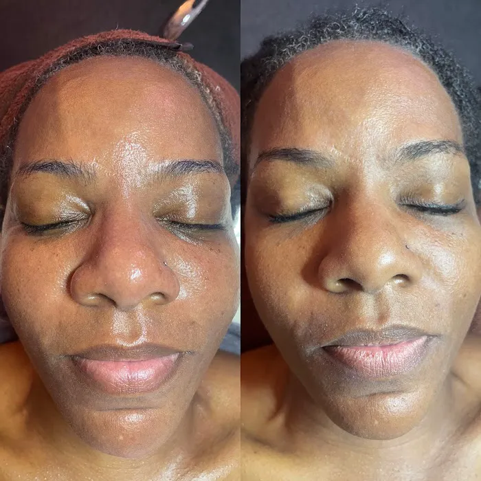 Joy Skincare Picture 9