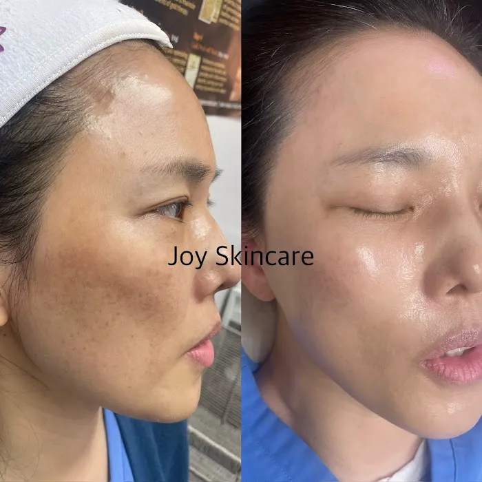 Joy Skincare Picture 8